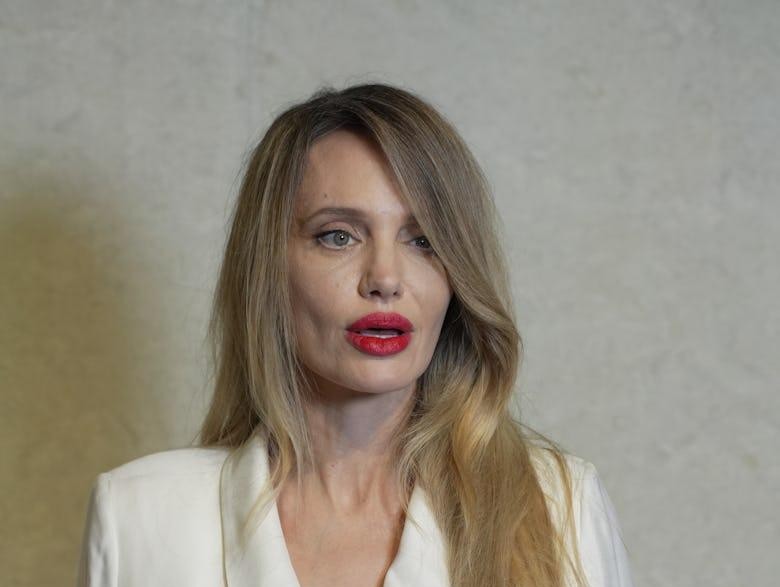 You are currently viewing What Happened to Angelina Jolie — and Why People Talk About “Bad Surgery”